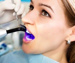 curing light being used on young woman’s teeth