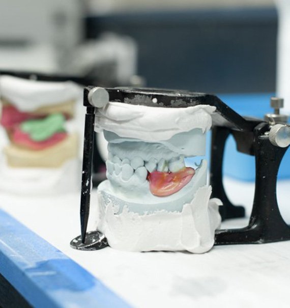 Dentures being crafted