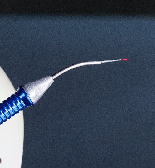 A soft tissue laser