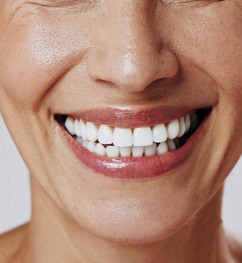 A closeup of a woman’s smile