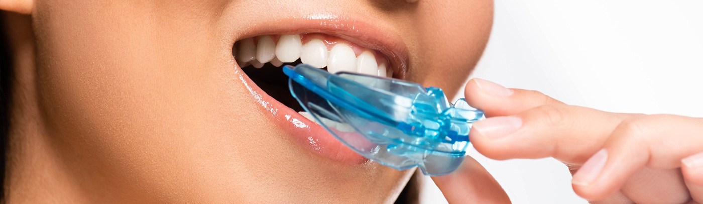 A custom nightguards from Antoon Dental will protect your smile from bruxism damage
