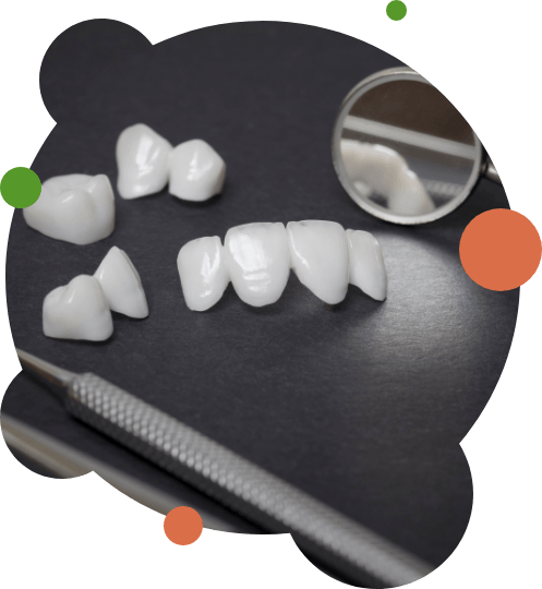 Metal-free restorations sitting next to dental instruments