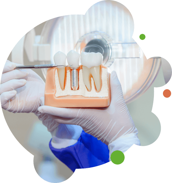 Holding and pointing to model of dental implant