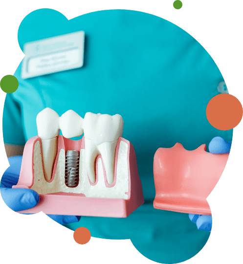 Showing model of dental implant and gums