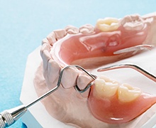 an example of a partial denture in Plano