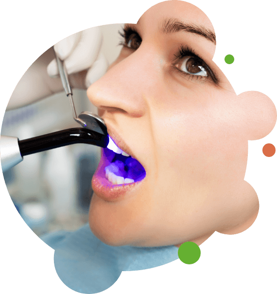 Close-up of woman receiving direct bonding in Plano for upper teeth