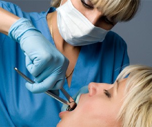 procedure for tooth extractions in Plano 