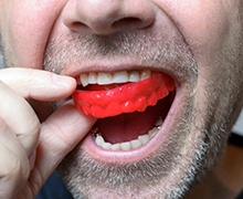 man putting a red mouthguard in his mouth 