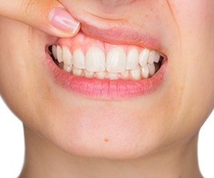 Woman smiling with healthy gums