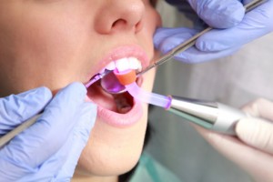 Woman getting an oral cancer screening