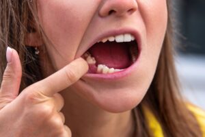 Woman with a missing premolar