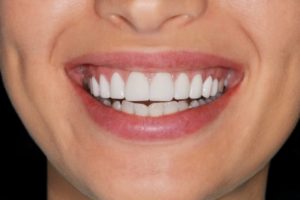 a woman with healthy gums