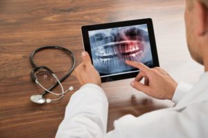 dentist holding tablet with digital x-ray